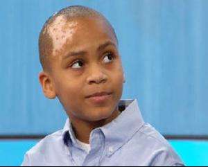 要防止白癜风带来的伤害要做好哪些呢